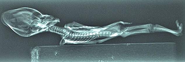 The Stanford team's 2018 research , however, was met with instant backlash as many questioned the findings and the ethics of the study itself, criticizing them for working with parties who arguably violated Chilean law by taking Ata's remains