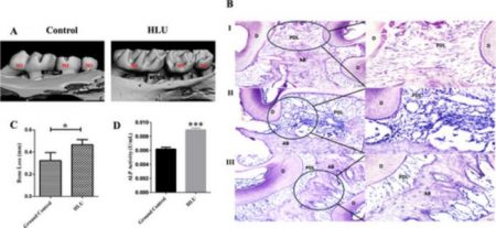 Spaceflight Could Be Bad For Your Teeth